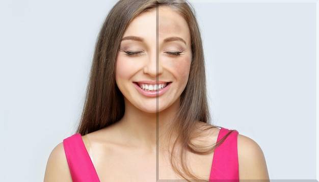 Wybielanie odbytu przed i po jakie efekty można uzyskać?