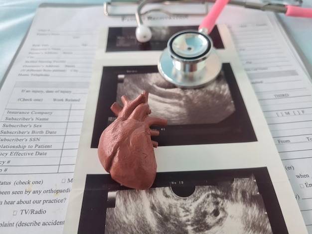 Jak długo trwa badanie echa serca i co warto o nim wiedzieć?