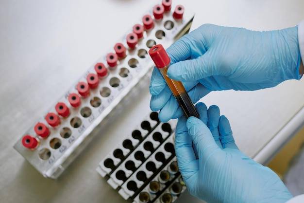 Jak interpretować morfologię krwi u dorosłych?