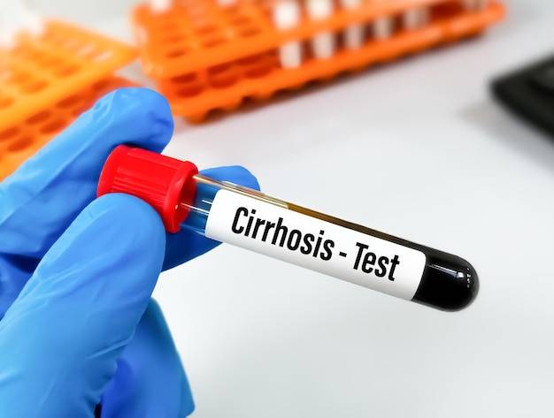 Jakie badania zrobić na SM aby postawić trafną diagnozę?