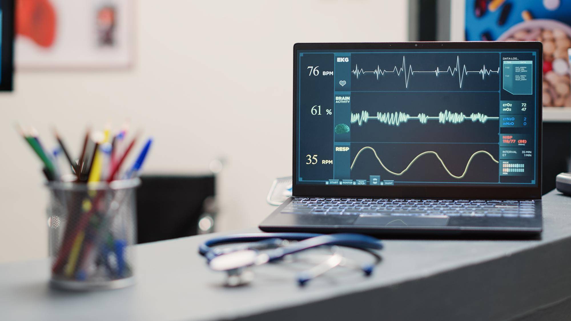 Czy EKG to echo serca?