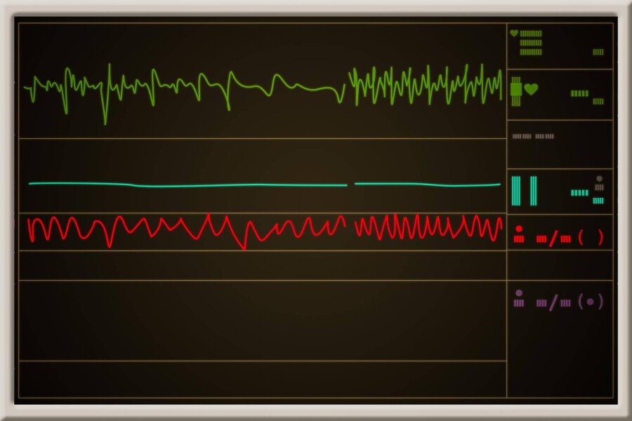 EKG a echo serca czym się różnią w diagnostyce chorób układu krążenia?