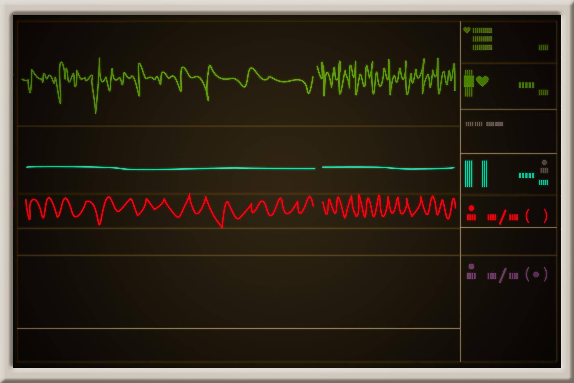 EKG a echo serca czym się różnią w diagnostyce chorób układu krążenia?