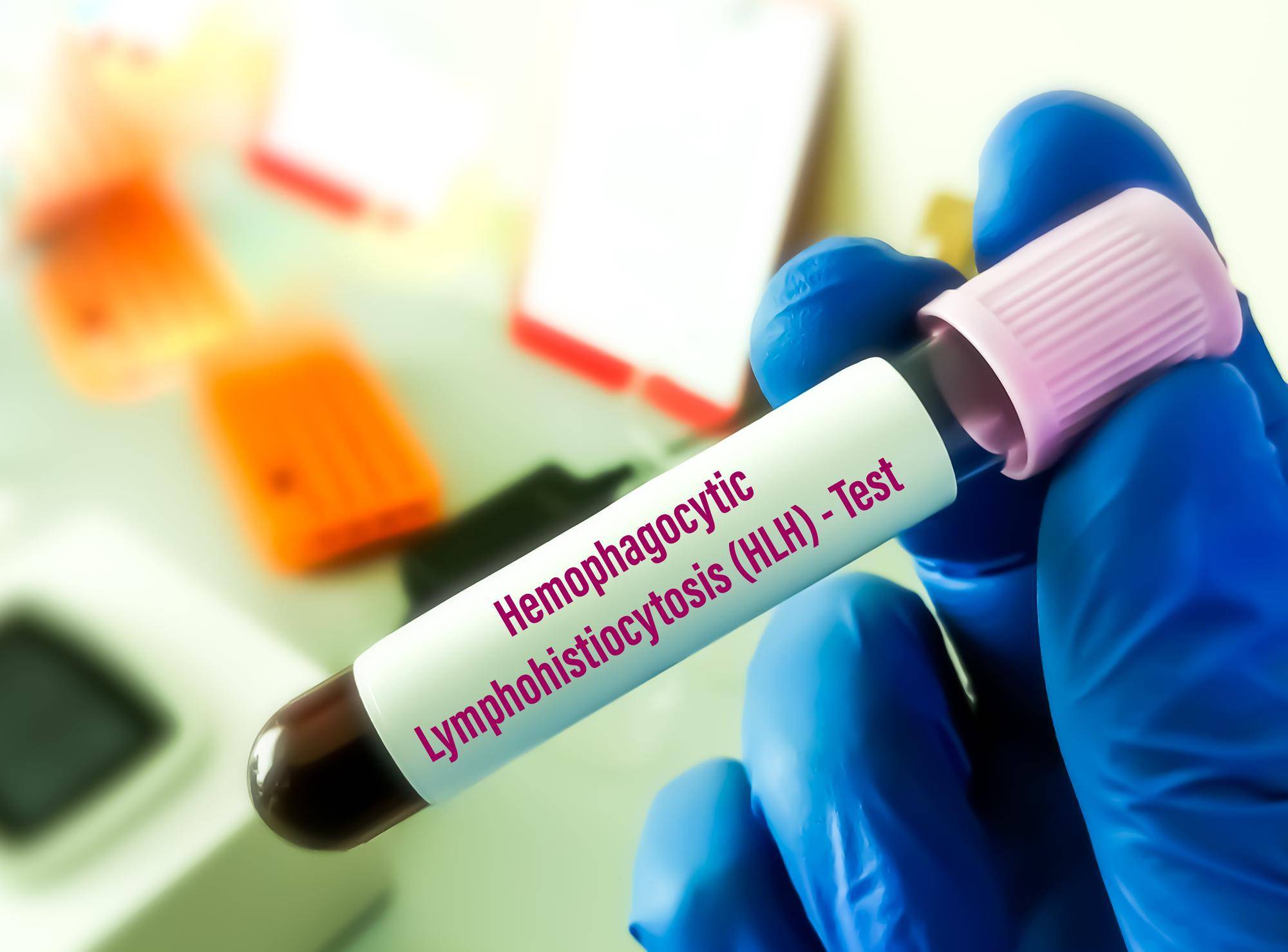 Jak przygotować się do badania poziomu hormonów tarczycy?