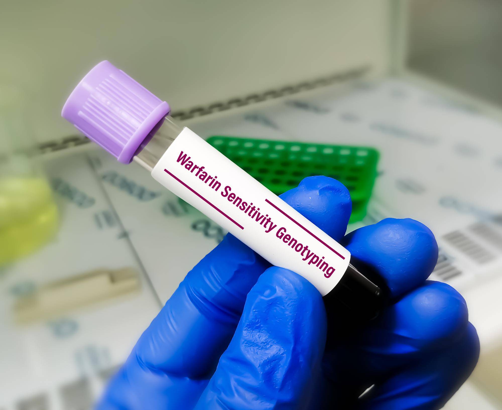 Jakie badania na wykrycie kandydozy są wykonywane w diagnostyce?