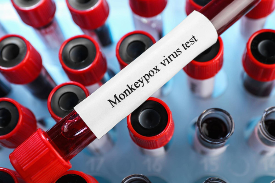 Jakie badania krwi na toczeń pozwalają potwierdzić diagnozę?